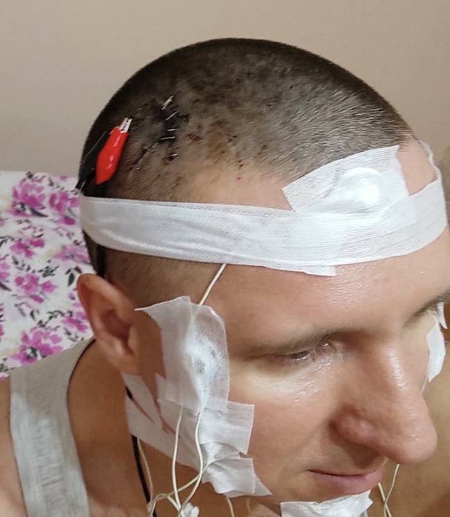Michael Raduga claims to have operated on his own brain. Credit: Instagram/@michael_raduga