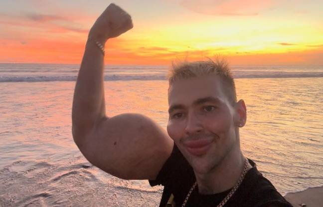 After having litres of petroleum jelly surgically removed from his arms he spent thousands of dollars on face filler. Credit: Instagram/@kirilltereshin96