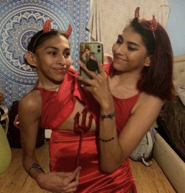 Conjoined Sentiments Conjoined twin explains how she met her boyfriend