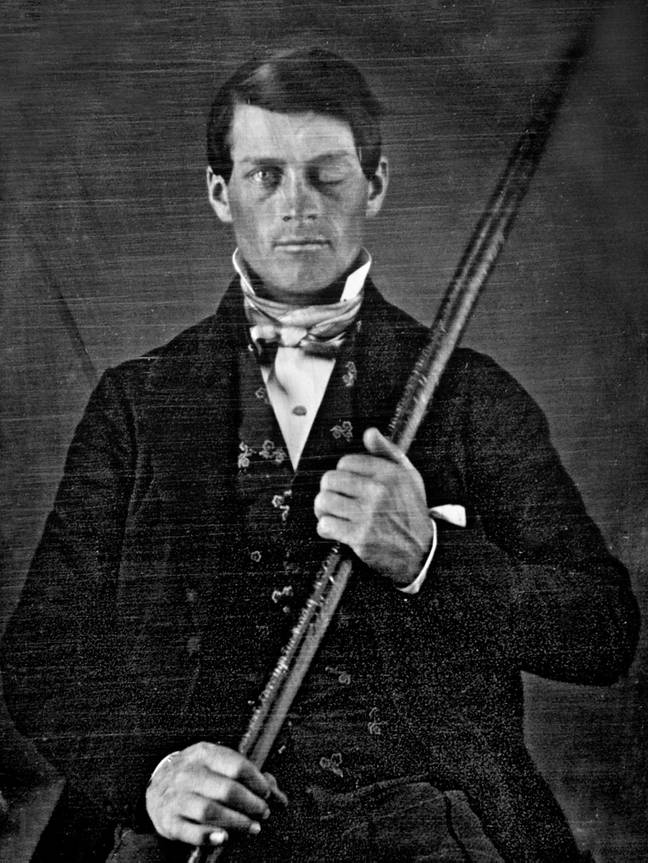 Phineas Gage was involved in a freak accident at work. Credit: IanDagnall Computing/Alamy Stock Photo