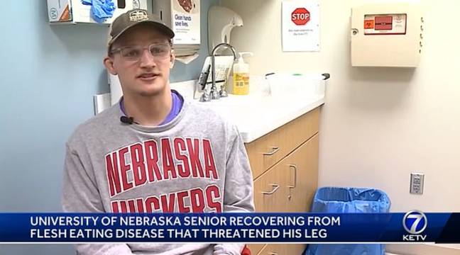 Peyton Robb could have lost his leg after contracting a rare infection. Credit: KCCI