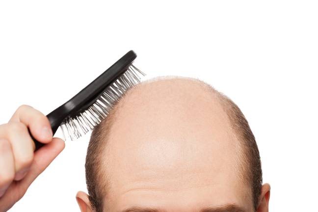 Judges have ruled that calling a man ‘bald’ is sexual harrasment. Credit: Alamy