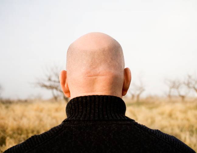 The judges also referenced their own baldness. Credit: Alamy
