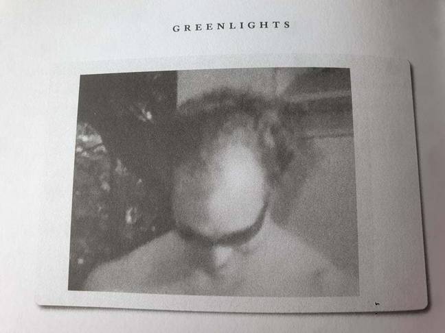 He opens up about his hair loss in his memoir, Greenlights. Credit: Greenlights