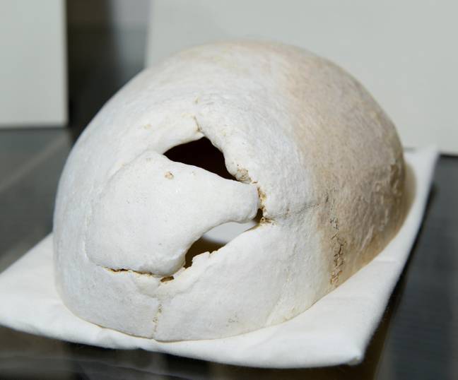 Gage's skull is now on display. Credit: Martin Shields / Alamy Stock Photo