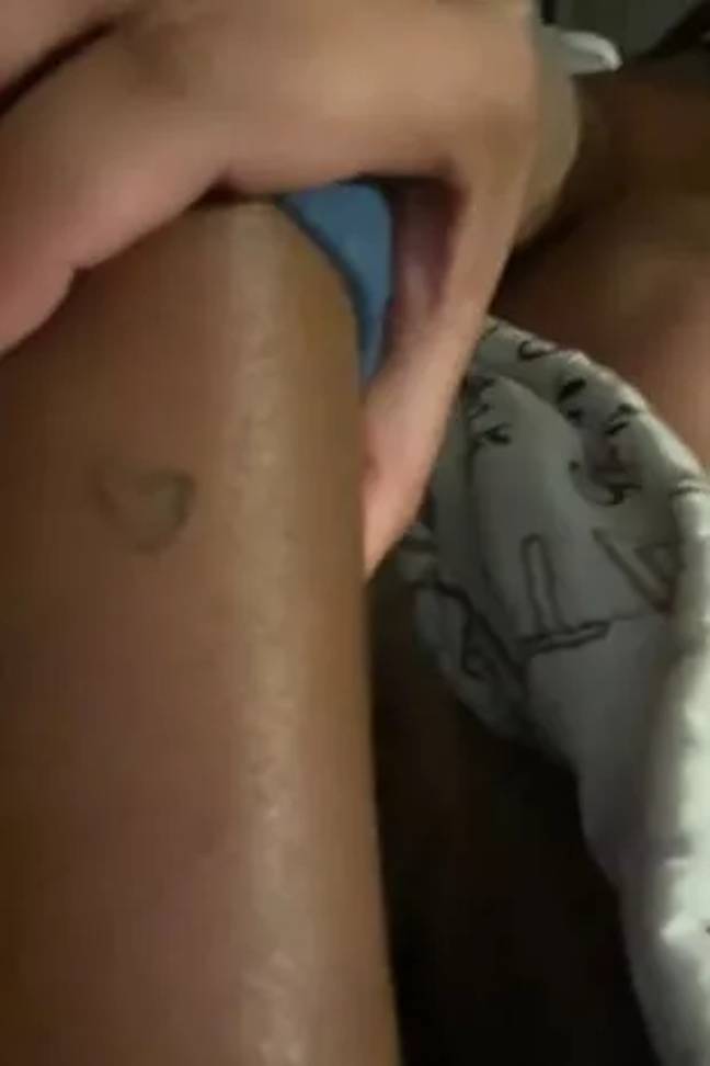 Here's what she found on her daughter's leg. Credit: TikTok/@newskii_soexotic24
