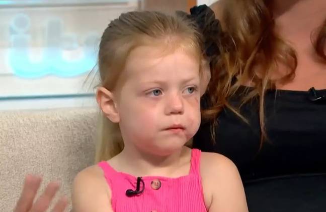 Luna-Ann's face was left scarred. Credit: Good Morning Britain/ITV