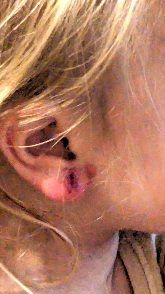 Jessica found 'two large gouges' in her daughter's ear lobes. Credit: Kennedy News &amp; Media