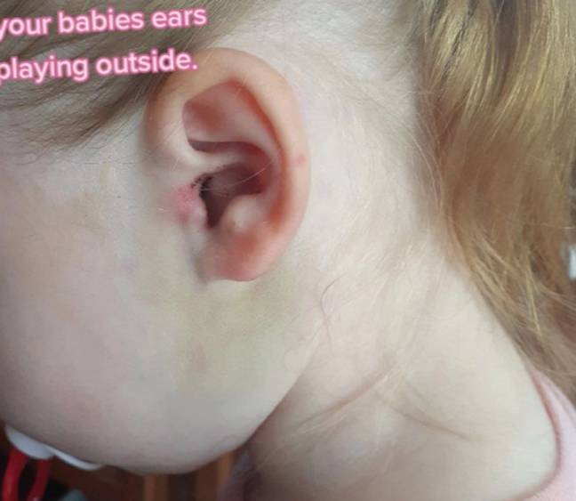Averie's ear was left bruised after the incident. Credit: TikTok/@mrs.jess1986