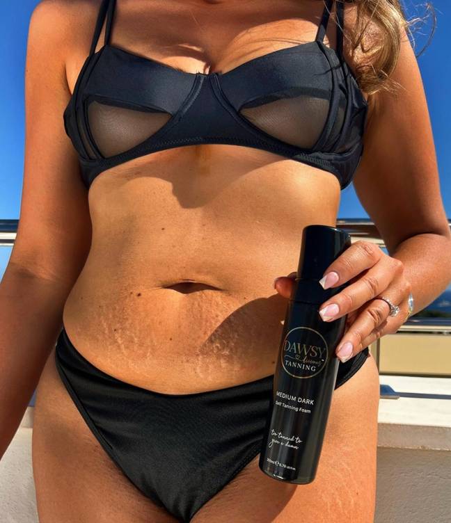 Fans are praising Charlotte Dawson after she opened up on her shaving rash and 'tiger stripes'. Credit: Charlotte Dawson/Instagram