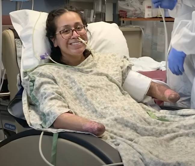 The 29-year-old had to have both her hands and feet amputated. Credit: KHOU 11