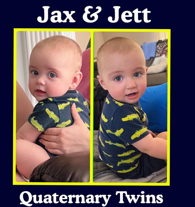 Jax and Jett are connected in more ways that one. (Credit: Instagram/@salyerstwins)