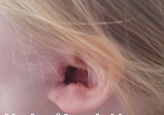 Jessica noticed her daughter's ear was irritated. Credit: TikTok/@mrs.jess1986