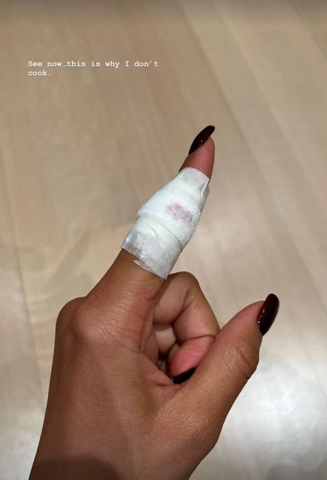 Zendaya told her fans about her cooking accident. Credit: @zendaya/Instagram.