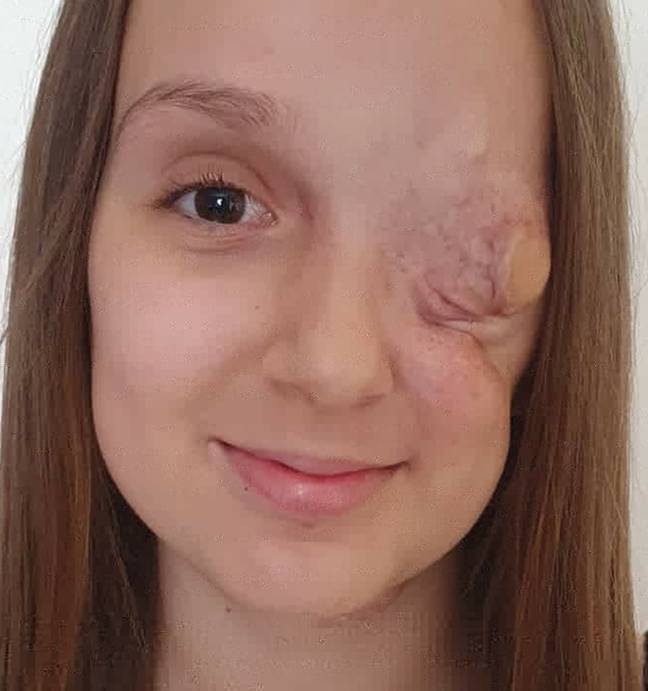 Doctors initially diagnosed the school girl with a cyst. Credit: Facebook / Dana Celic