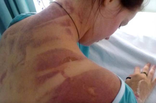 Woman Who Fell 360 Feet After Bungee Cord Snapped Shares Images Of Her Woman Who Fell 360 Feet After Bungee Cord Snapped Shares Images Of Her