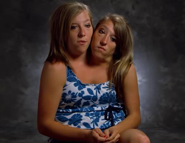 Abby and Brittany Hensel are conjoined twins. Credit: YouTube/OMG Stories