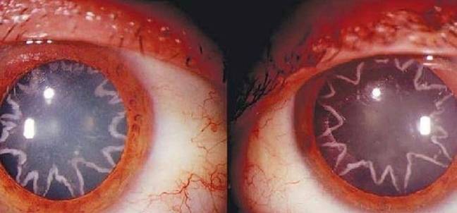 A California man was left with strange star-shaped eyes after a horrific accident at work