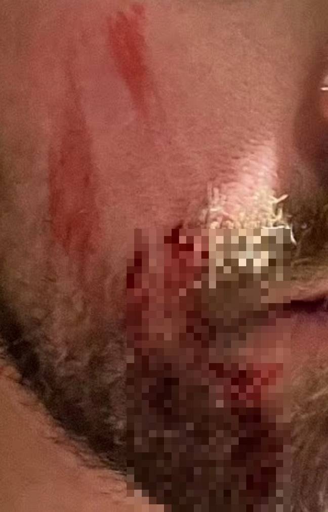 The man had to have five stitches. Credit: Facebook/Mums of Boys Australia
