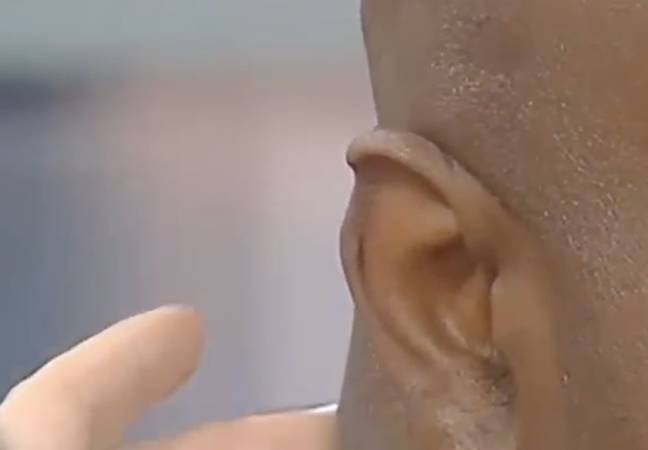 As you can see, there's definitely a chunk missing from Holyfield's ear. Credit: YouTube/Fox 5 New York