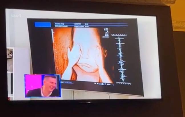 The baby scan was fake. Credit: ITV/ @jadee_louisee/ TikTok