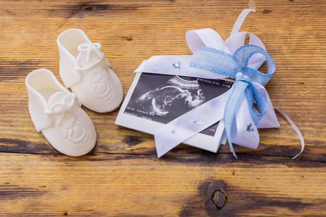 The father missed the gender reveal scan. Credit: Lennystan / Alamy Stock Photo