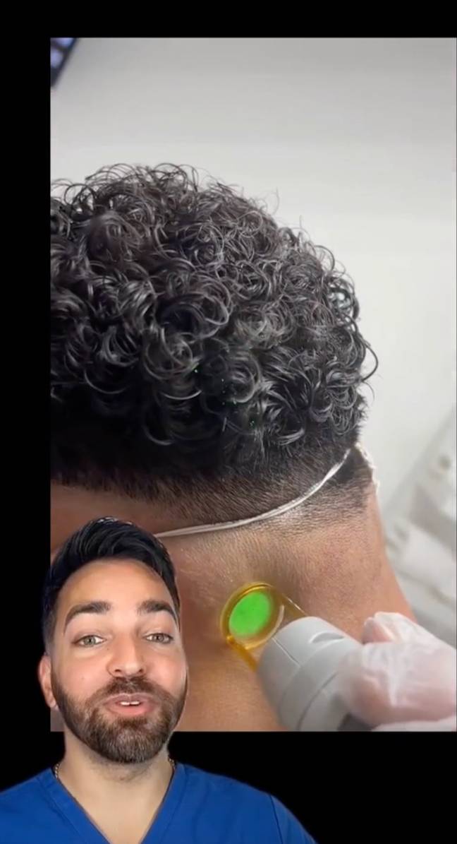 One doctor has warned about dangers of men getting 'permanent haircut'. Credit: TikTok/@dermdoctor