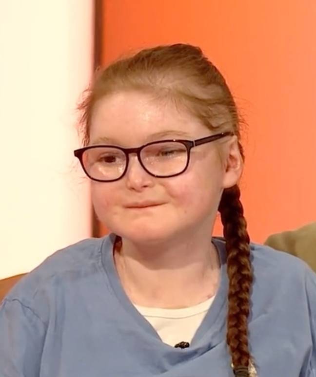 The young girl from Black Isle was born with 'butterfly skin' and often finds herself wrapped head to toe in bandages, which need to be changed three times a week. Credit: BBC