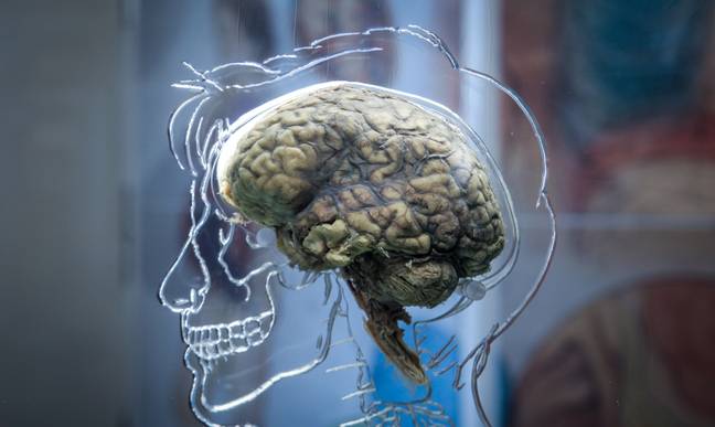 What's going on in the brain? Credit: Matt Cardy/Getty Images