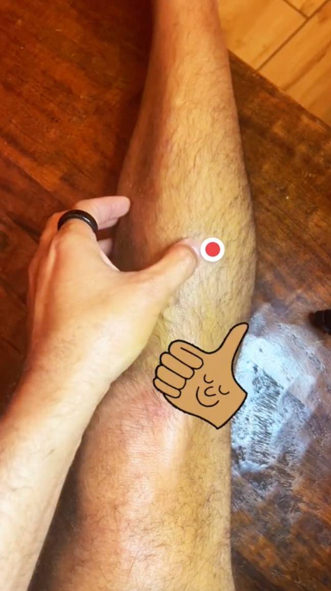 There's a pressure point below your knee, which if you press it in the right way, might stop you from feeling the urge to use the restroom. Credit: TikTok/@acupuncturefit