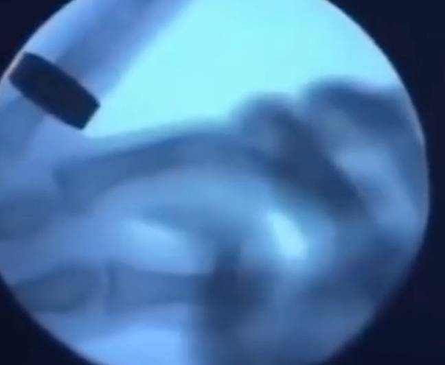 The clip shows an X-ray video of finger knuckles being cracked. Credit: TikTok/@interesting_af
