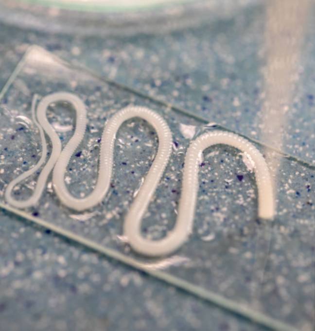 The tapeworm usually stays in the intestines and causes no to mild symptoms. Credit: Shutterstock