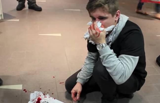 He got his nose broken after pretending to rob someone at a cash machine. Credit: YouTube/RecklessYouth