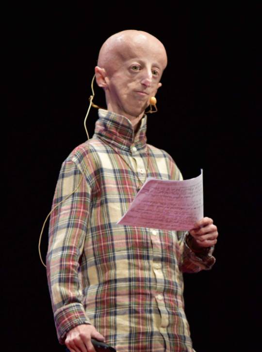 Benjamin Button Rapper Benjamin Button Disease