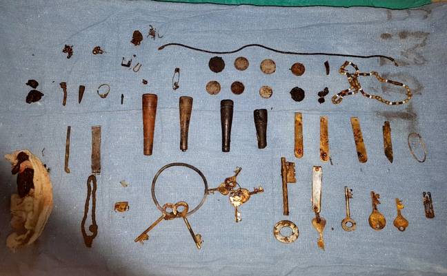 The bizarre haul included coins, knives and keys. Credit: SWNS