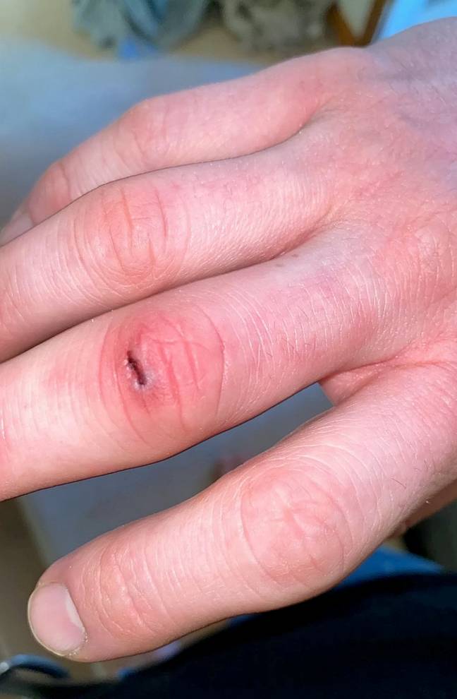 The initial cut on Steve's finger. Credit: SWNS