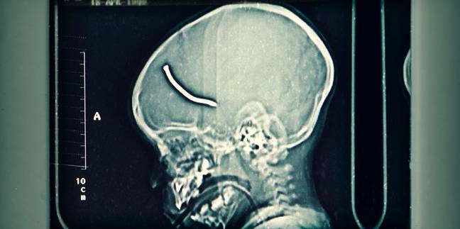 An unnamed child survived after a nail embedded in his brain after the Brixton bombing (Credit: Netflix)
