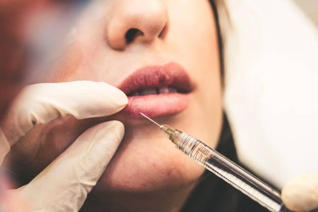 Lip fillers were hugely popular in the mid 2010's (Credit: Unsplash)