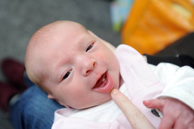One in every 2,000 babies is born with natal teeth. Credit: SWNS