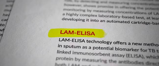 The test to detect TB at the time was called the LAM-ELISA test (Credit: Netflix)