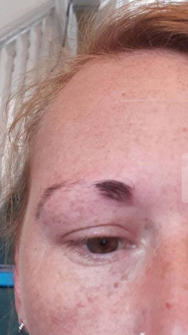 Colline's first therapist waxed off half her eyebrow [Credit: Triangle News] 