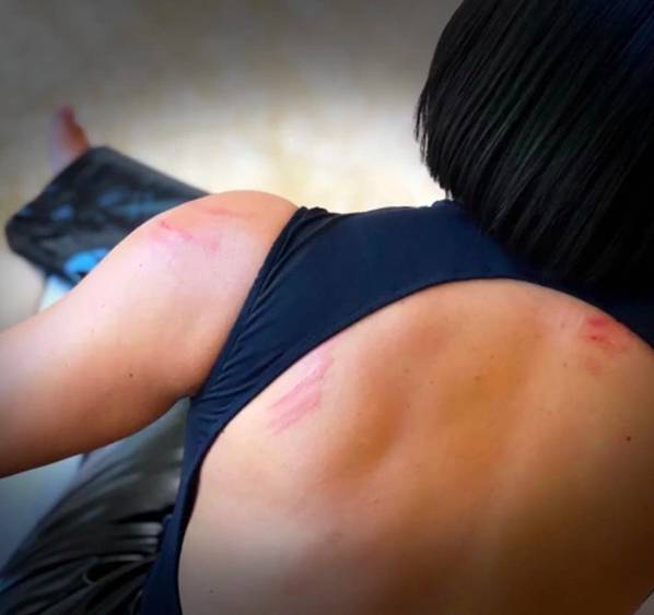 Kim's back appeared to have scratches as she walked away (Credit: Keeping Up With The Kardashians/ E!) 