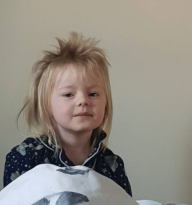 The toddler was left looking like David Bowie as her hair began to grow back (Credit: Kennedy News and Media)