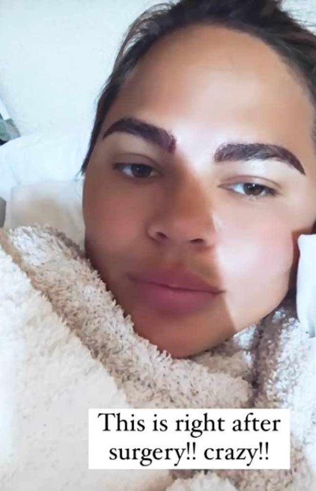 Chrissy Teigen warned teens against plucking their eyebrows (Credit: Chrissy Teigen/Instagram)