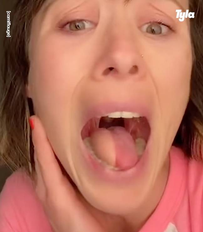 Cameron discussed her tongue surgery. Credit: @camiflauge/TikTok.
