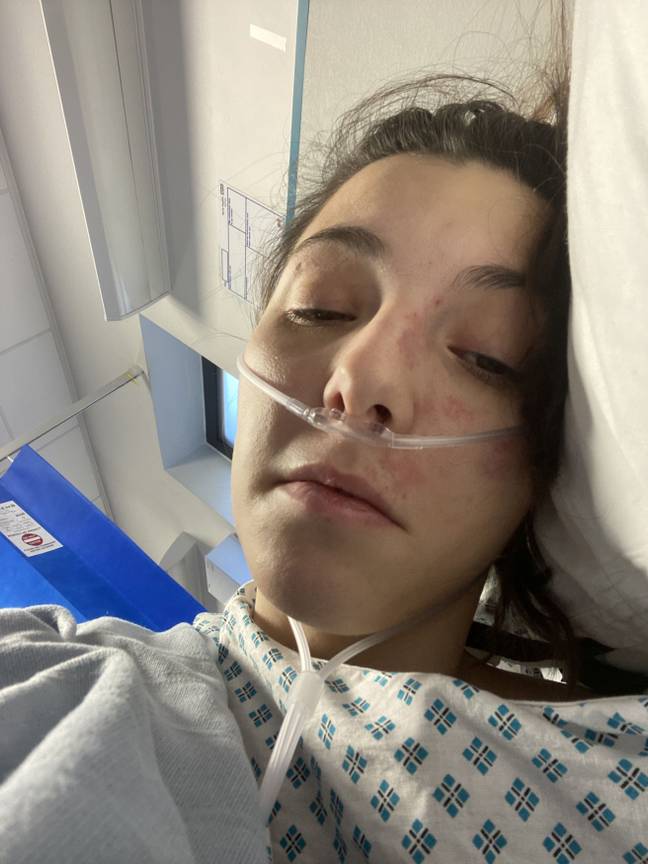 Lauren was rushed to hospital where an X-Ray revealed different sized pieces of glass in her stomach. (Credit: Kennedy News)