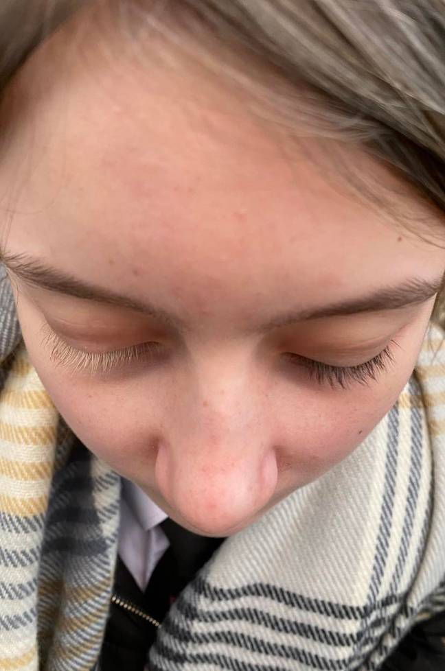 Bella's eyelashes are blonde and brunette too (Credit: Kennedy News and Media)