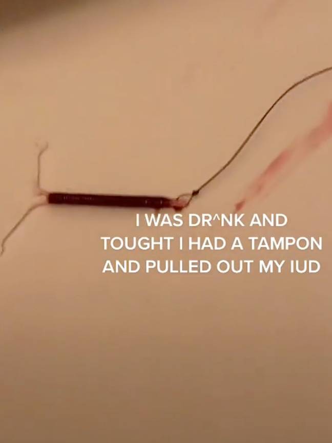Natalia explained she accidentally removed her IUD (Credit: TikTok/@ilikem4ng0)