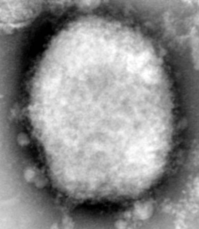 Monkeypox under a microscope. Credit: Alamy