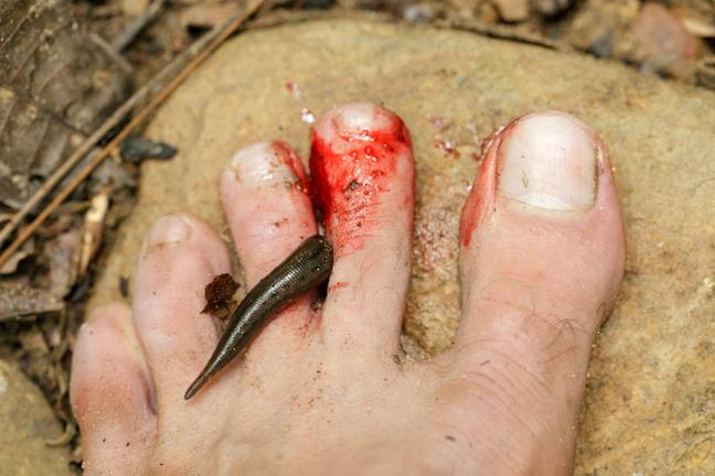 Leeches aren’t dangerous, but hosts rarely feel their bites. Credit: Alamy 